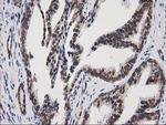 PRKCE Antibody in Immunohistochemistry (Paraffin) (IHC (P))