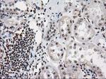 PRKCE Antibody in Immunohistochemistry (Paraffin) (IHC (P))