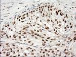 PRKCE Antibody in Immunohistochemistry (Paraffin) (IHC (P))