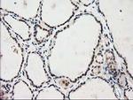 PRKCE Antibody in Immunohistochemistry (Paraffin) (IHC (P))