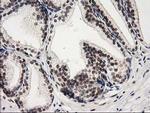 PRKCE Antibody in Immunohistochemistry (Paraffin) (IHC (P))