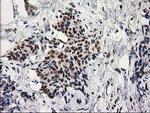 PRKCE Antibody in Immunohistochemistry (Paraffin) (IHC (P))