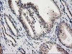 PRKCE Antibody in Immunohistochemistry (Paraffin) (IHC (P))