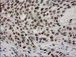 PRKCE Antibody in Immunohistochemistry (Paraffin) (IHC (P))