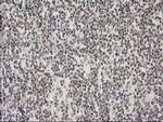 PRKCE Antibody in Immunohistochemistry (Paraffin) (IHC (P))