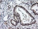 PRKCE Antibody in Immunohistochemistry (Paraffin) (IHC (P))