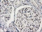 PRKCE Antibody in Immunohistochemistry (Paraffin) (IHC (P))