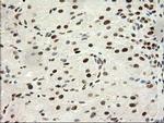 PRKCE Antibody in Immunohistochemistry (Paraffin) (IHC (P))