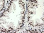 PRKCE Antibody in Immunohistochemistry (Paraffin) (IHC (P))