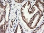 PRKCE Antibody in Immunohistochemistry (Paraffin) (IHC (P))