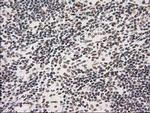 PRKCE Antibody in Immunohistochemistry (Paraffin) (IHC (P))