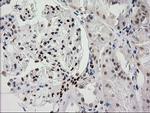 PRKCE Antibody in Immunohistochemistry (Paraffin) (IHC (P))