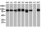 PRKCE Antibody in Western Blot (WB)