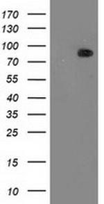 PRKCE Antibody in Western Blot (WB)