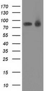 PRKCE Antibody in Western Blot (WB)