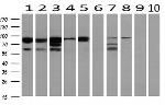 PRKCE Antibody in Western Blot (WB)