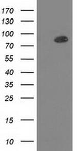 PRKCE Antibody in Western Blot (WB)