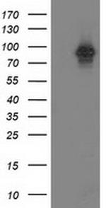 PRKCE Antibody in Western Blot (WB)