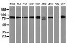 PRKCE Antibody in Western Blot (WB)