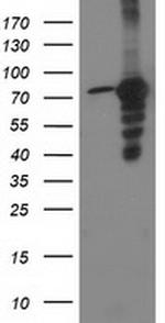 PRKCE Antibody in Western Blot (WB)