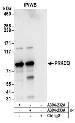 PRKCQ Antibody in Western Blot (WB)