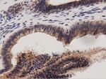 PRKD2 Antibody in Immunohistochemistry (Paraffin) (IHC (P))