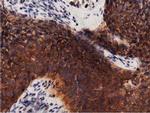 PRKD2 Antibody in Immunohistochemistry (Paraffin) (IHC (P))