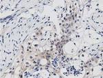 PRKD2 Antibody in Immunohistochemistry (Paraffin) (IHC (P))