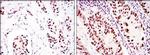 DNA-PK Antibody in Immunohistochemistry (Paraffin) (IHC (P))