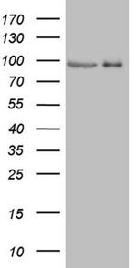 PRKG2 Antibody in Western Blot (WB)