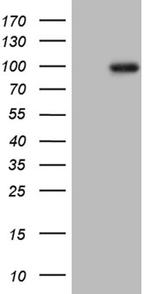 PRKG2 Antibody in Western Blot (WB)