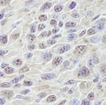 PRKRIR Antibody in Immunohistochemistry (IHC)