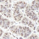 PRKRIR Antibody in Immunohistochemistry (IHC)