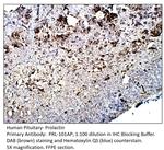 Prolactin Antibody in Immunohistochemistry (IHC)