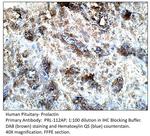 Prolactin Antibody in Immunohistochemistry (IHC)