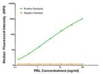 PRL Antibody in Luminex (LUM)