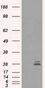 PRL Antibody in Western Blot (WB)