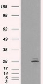 PRL Antibody in Western Blot (WB)