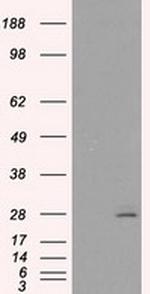 PRL Antibody in Western Blot (WB)