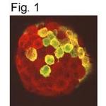 Prolactin Receptor Antibody in Immunohistochemistry (IHC)