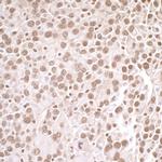 PRMT1 Antibody in Immunohistochemistry (IHC)