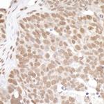 PRMT1 Antibody in Immunohistochemistry (IHC)