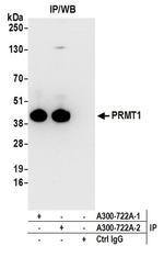 PRMT1 Antibody in Western Blot (WB)