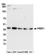 PRMT1 Antibody in Western Blot (WB)