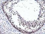 PRMT2 Antibody in Immunohistochemistry (Paraffin) (IHC (P))