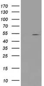 PRMT2 Antibody in Western Blot (WB)