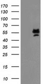 PRMT2 Antibody in Western Blot (WB)