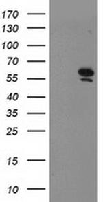 PRMT2 Antibody in Western Blot (WB)