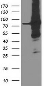 PRMT2 Antibody in Western Blot (WB)