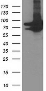 PRMT2 Antibody in Western Blot (WB)